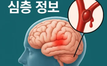 뇌출혈 원인 30가지와 예방법 총정리